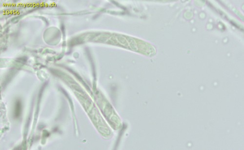 Orbilia eucalypti - 