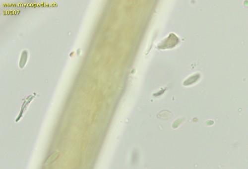 Leptosporomyces septentrionalis - Sporen - 