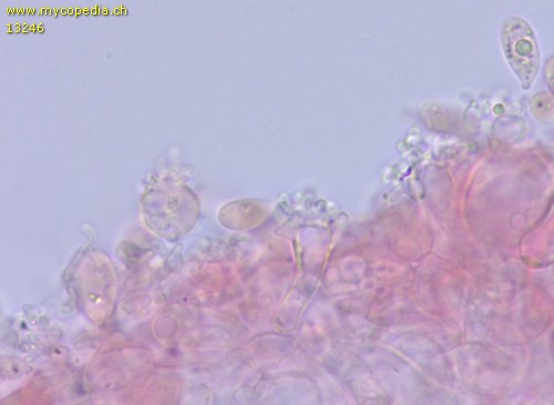 Collybiopsis ramealis - Cheilozystiden - 