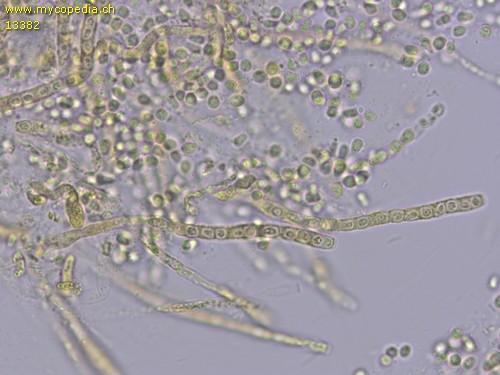 Trichoderma gelatinosum - 