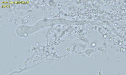 Corticium macrosporopsis - Gloeozystiden - Wasser  - 