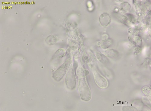 Lepiota subincarnata - Cheilozystiden - 