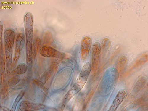 Scutellinia cejpii - Paraphysen - Baumwollblau  - 