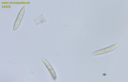 Hymenoscyphus scutula - Sporen - Wasser  - 