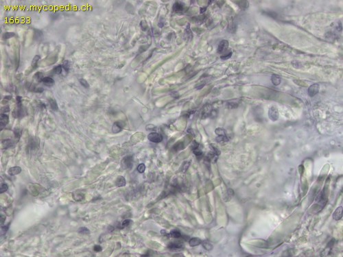 Gloeocystidiellum porosum - Sporen - Melzers  - 