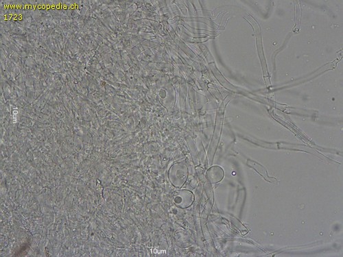 Singerocybe phaeophthalma - HDS mit blasigen Zellen - 