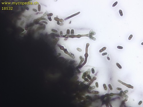 Chaetosphaerella phaeostroma - 