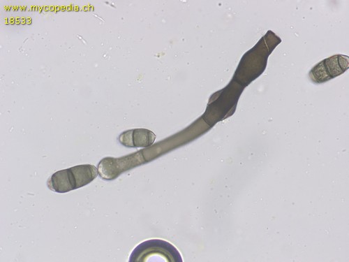 Chaetosphaerella phaeostroma - 