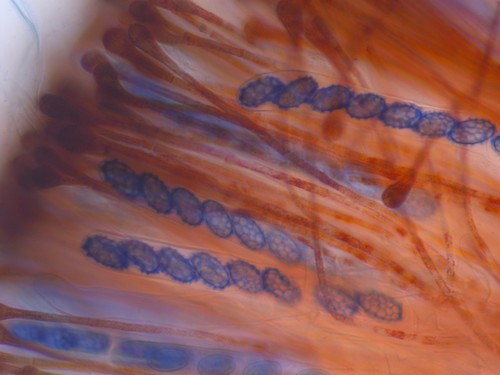 Melastiza cornubiensis - 