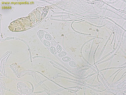 Ascobolus carbonarius - 