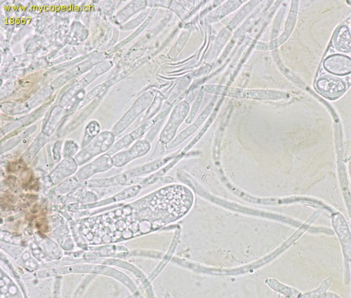 Ascobolus carbonarius - 