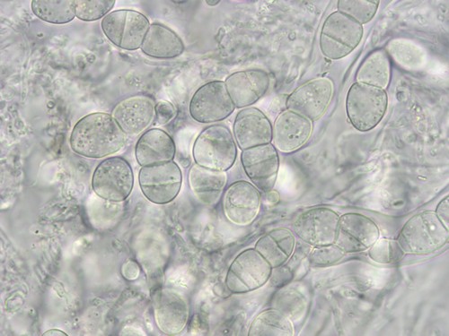 Didymella Mauersporer unbeschrieben - 
