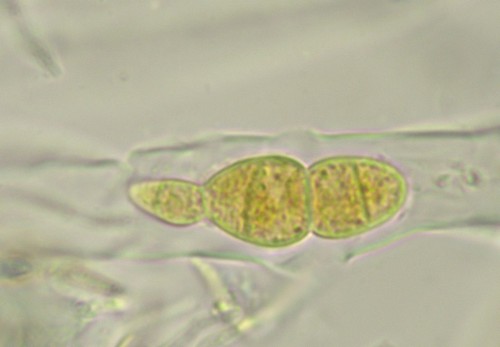 Didymella Mauersporer unbeschrieben - 
