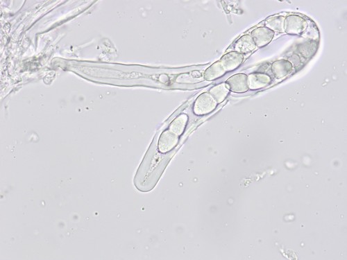 Didymella Mauersporer unbeschrieben - 