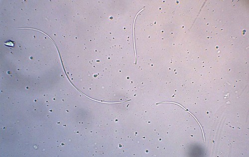 Vibrissea filispora f. boudieri - 