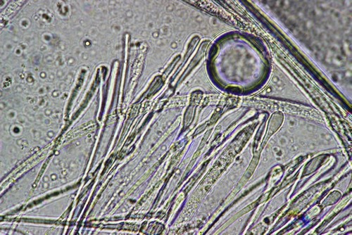 Vibrissea filispora f. boudieri - Paraphysen - 