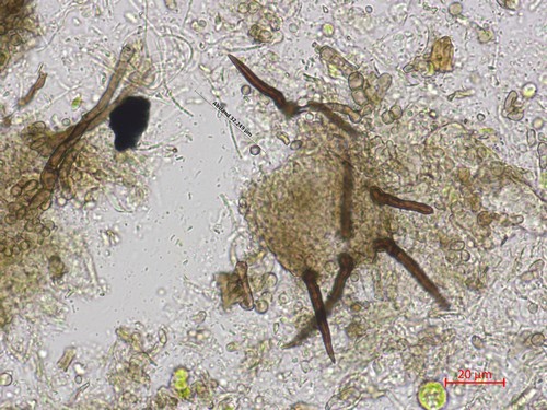 Vexillomyces xylophilus - Setae -
