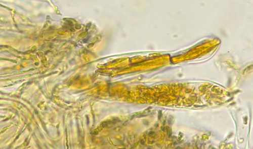 Vexillomyces xylophilus - Asci - Baral  -