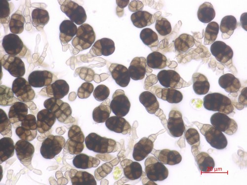 Berkleasmium tetraploides - 