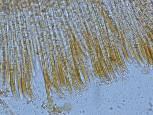 Byssonectria terrestris - Paraphysen - 