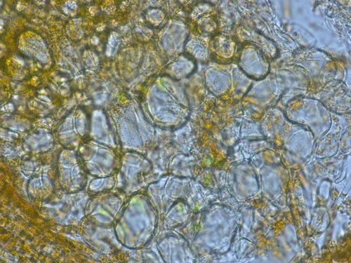 Byssonectria terrestris - Excipulum - 