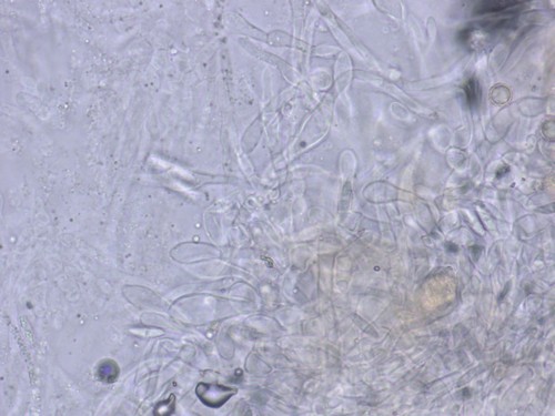 Hypomyces lateritius - 