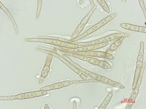 Wilsonomyces carpophilus - 