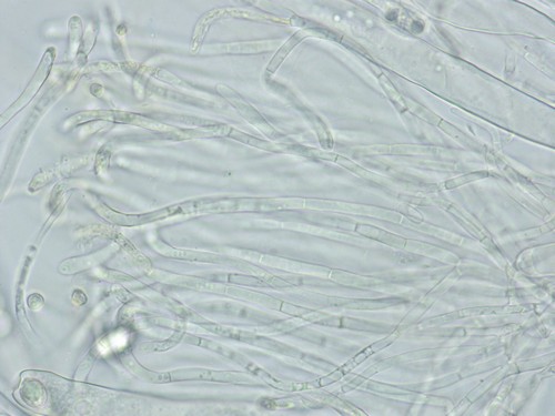 Otidea platyspora - Paraphysen - Wasser  - 
