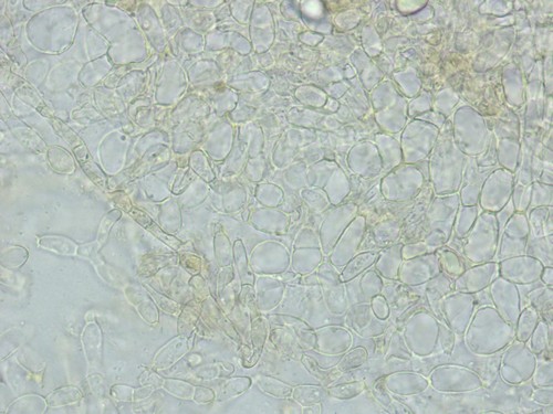 Otidea platyspora - Excipulum - Wasser  - 