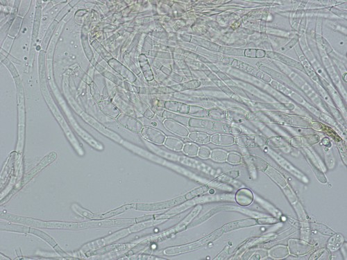 Otidea platyspora - Paraphysen - 