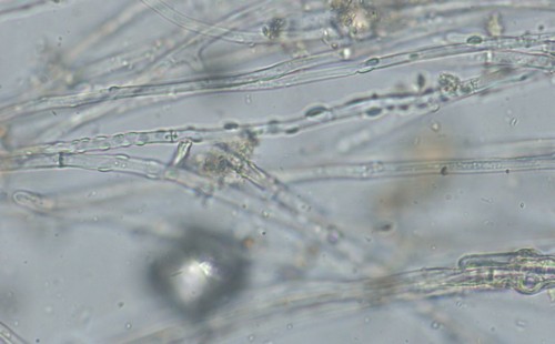 Otidea platyspora - Mycel - 