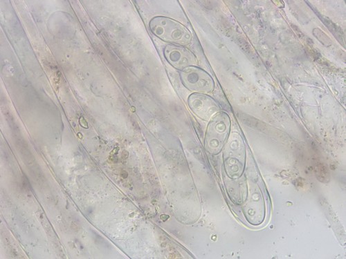 Daleomyces exogelatinosus - Asci - Wasser  - 