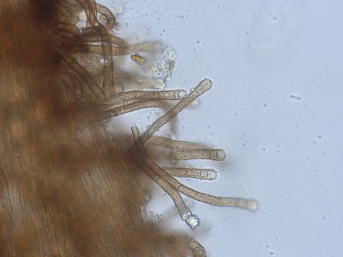 Brunnipila clandestina - 