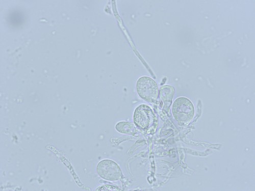 Tremella globispora - 