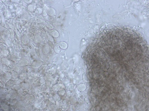 Tremella globispora - 