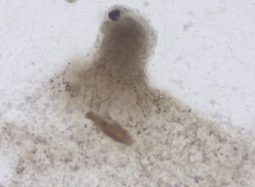 Tremella globispora - 
