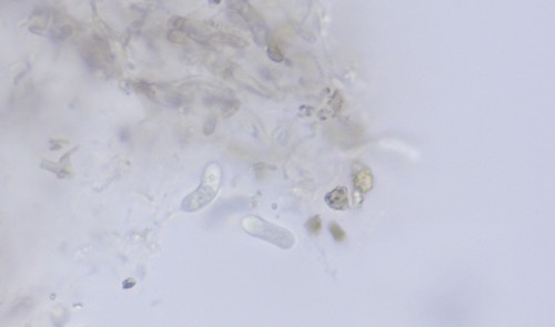 Tremella globispora - 