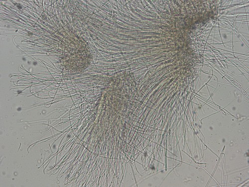 Stictis radiata - Paraphysen - Wasser  - 