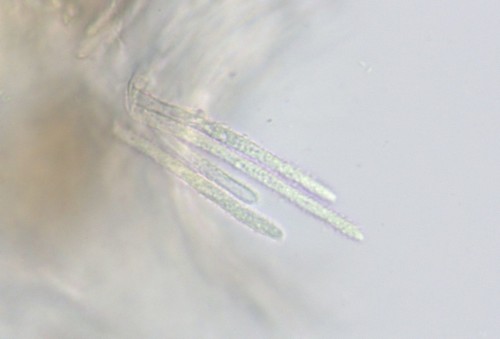 Capitotricha rubi - Haarb�schel - Wasser  - 