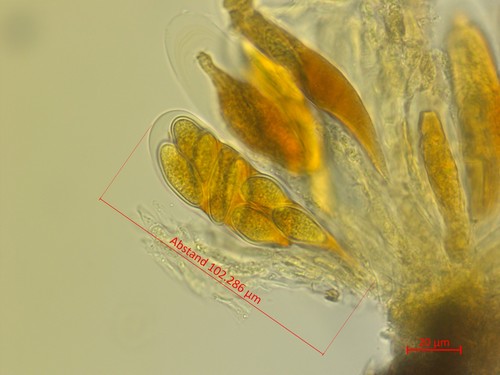 Botryosphaeria dothidea - Asci - Melzers  - 