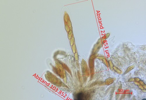 Botryosphaeria dothidea - Asci - Melzers  - 