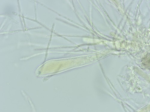 Patellariopsis atrovinosa - Asci - Melzers  - 
