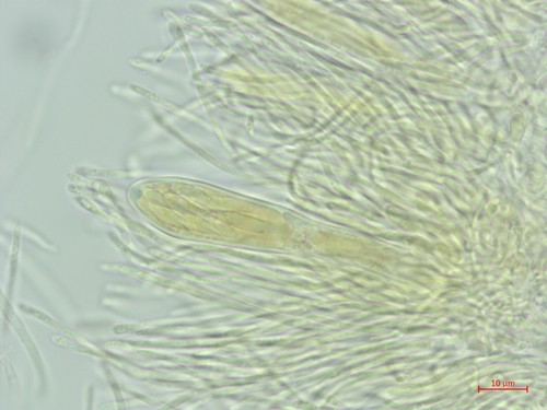 Patellariopsis atrovinosa - Asci - Melzers  - 