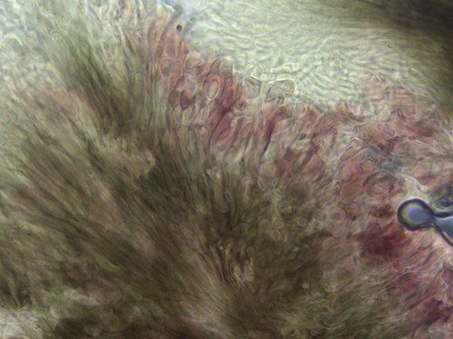 Patellariopsis atrovinosa - Excipulum - Melzers  - 