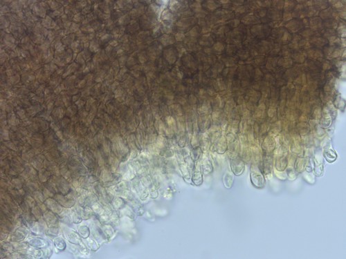 Patellariopsis atrovinosa - Excipulum - 