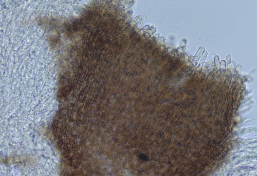 Patellariopsis atrovinosa - Excipulum - 