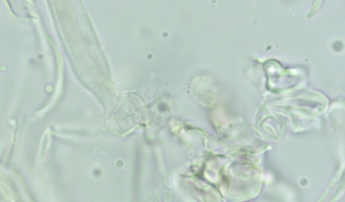 Patellariopsis atrovinosa - Ascus mit Basalschnalle - 