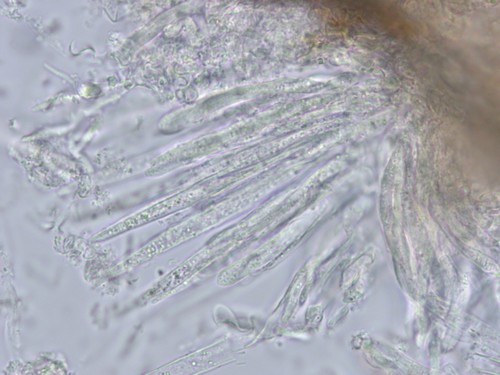 Trichopezizella nidulus - Paraphysen - Wasser  - 