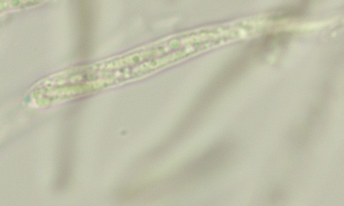 Trichopezizella nidulus - Ascus - Melzers  - 