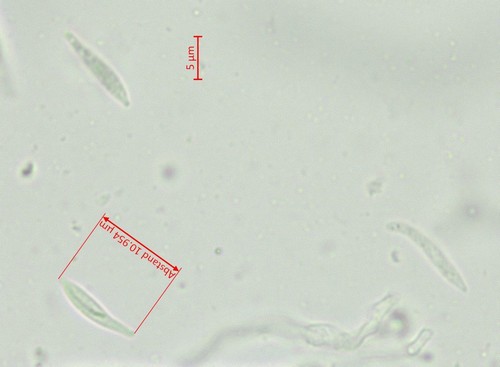 Orbilia filiformis - Spore/n - Wasser  - 
